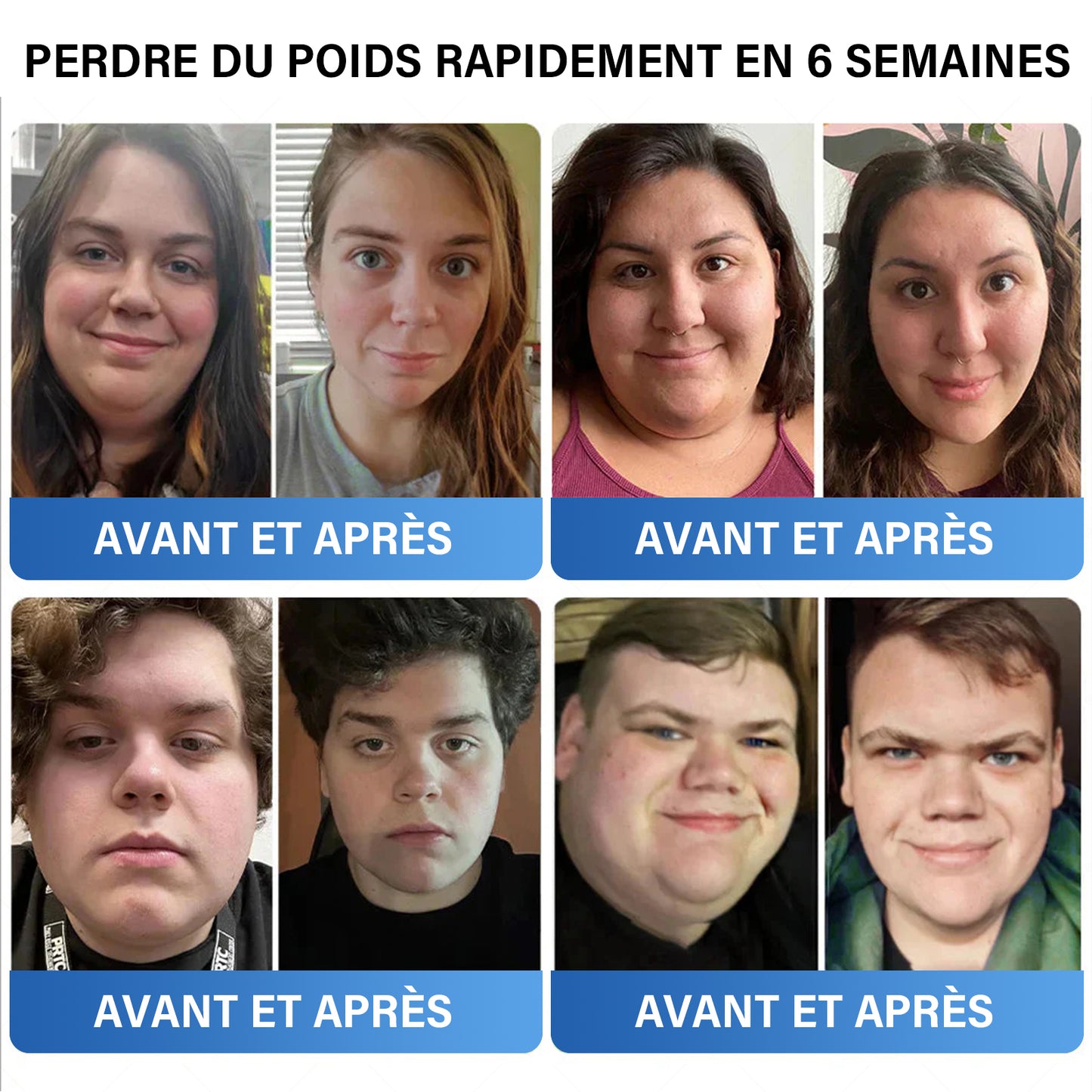 [Voir les résultats en 7 jours]🎁𝐀𝐀Ғ𝐐®🎁𝐏𝐚𝐭𝐜𝐡 𝐚𝐮𝐱 𝐦𝐢𝐜𝐫𝐨𝐚𝐢𝐠𝐮𝐢𝐥𝐥𝐞𝐬 𝐒𝐌𝐆𝐓-𝐆 𝐋 𝐏 𝟏 𝐍𝐚𝐧𝐨 (Sans douleur • Effet prolongé • Cible le 𝐝𝐢𝐚𝐛è𝐭𝐞, l'𝐨𝐛é𝐬𝐢𝐭é et les 𝐦𝐚𝐥𝐚𝐝𝐢𝐞𝐬 𝐜𝐚𝐫𝐝𝐢𝐨𝐯𝐚𝐬𝐜𝐮𝐥𝐚𝐢𝐫𝐞𝐬)