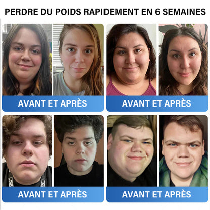 [Voir les résultats en 7 jours]🎁𝐀𝐀Ғ𝐐®🎁𝐏𝐚𝐭𝐜𝐡 𝐚𝐮𝐱 𝐦𝐢𝐜𝐫𝐨𝐚𝐢𝐠𝐮𝐢𝐥𝐥𝐞𝐬 𝐒𝐌𝐆𝐓-𝐆 𝐋 𝐏 𝟏 𝐍𝐚𝐧𝐨 (Sans douleur • Effet prolongé • Cible le 𝐝𝐢𝐚𝐛è𝐭𝐞, l'𝐨𝐛é𝐬𝐢𝐭é et les 𝐦𝐚𝐥𝐚𝐝𝐢𝐞𝐬 𝐜𝐚𝐫𝐝𝐢𝐨𝐯𝐚𝐬𝐜𝐮𝐥𝐚𝐢𝐫𝐞𝐬)